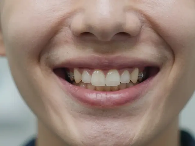 Jak se zbavit předkusu po rovnátkách - praktický návod