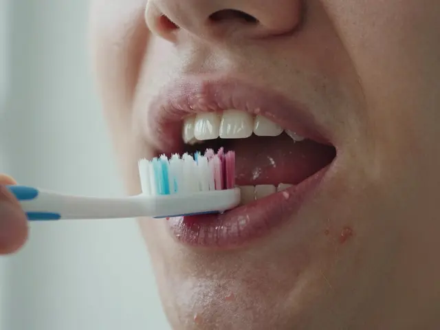 Jak vypadá začínající paradentóza? První příznaky, které byste neměli ignorovat