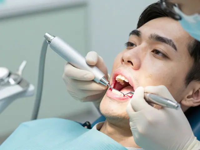 Kyretáž zubů: Před a po - co se stane během a po léčbě