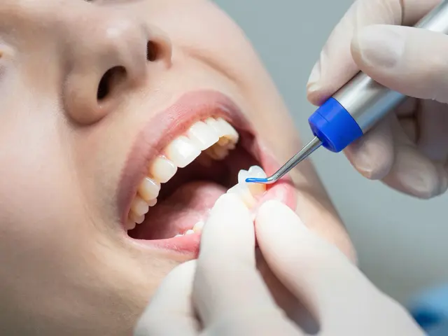 Jak dlouho vydrží bílá plomba? Vše, co potřebujete vědět o trvání estetických plomb