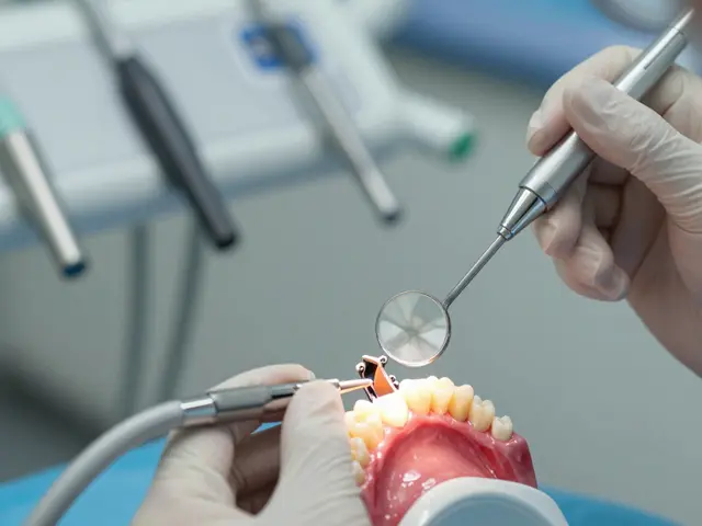 Jak se sundá zubní můstek? Průvodce procesem od odstranění po obnovu