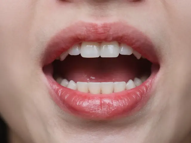 Vše, co jste kdy chtěli vědět o zubním kameni pod dásní