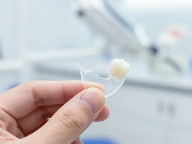 Fazety na přední zuby: Jak vybrat ten správný typ a dosáhnout přirozeného úsměvu