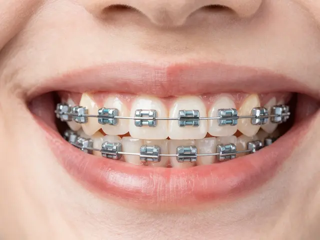 Invisalign vs. keramická rovnátka: Která cesta k rovným zubům je pro vás lepší?