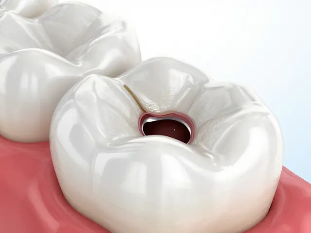 Jak zastavit kaz pod keramickými fasety a zachránit zub