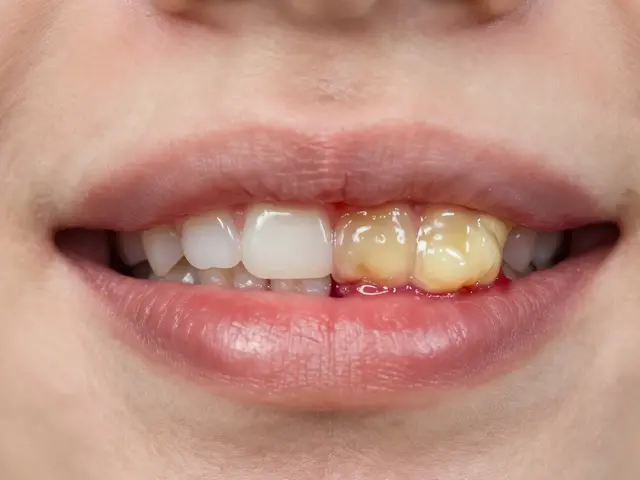 Jak poznat hnis po extrakci zuba? Příznaky, rizika a kdy volat lékaře
