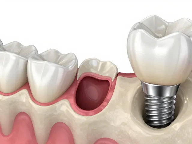 Jak zubní implantáty zlepšují život po léčbě kazu: Komplexní průvodce